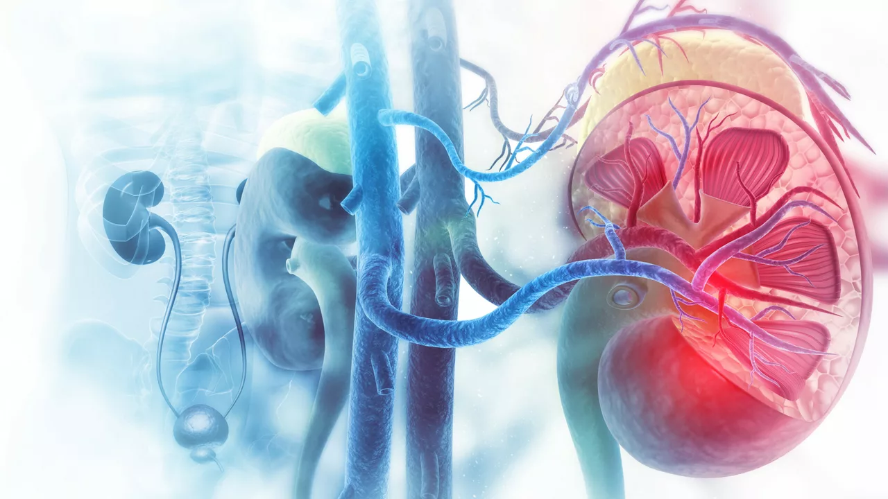 The Relationship Between Embolism and Kidney Disease